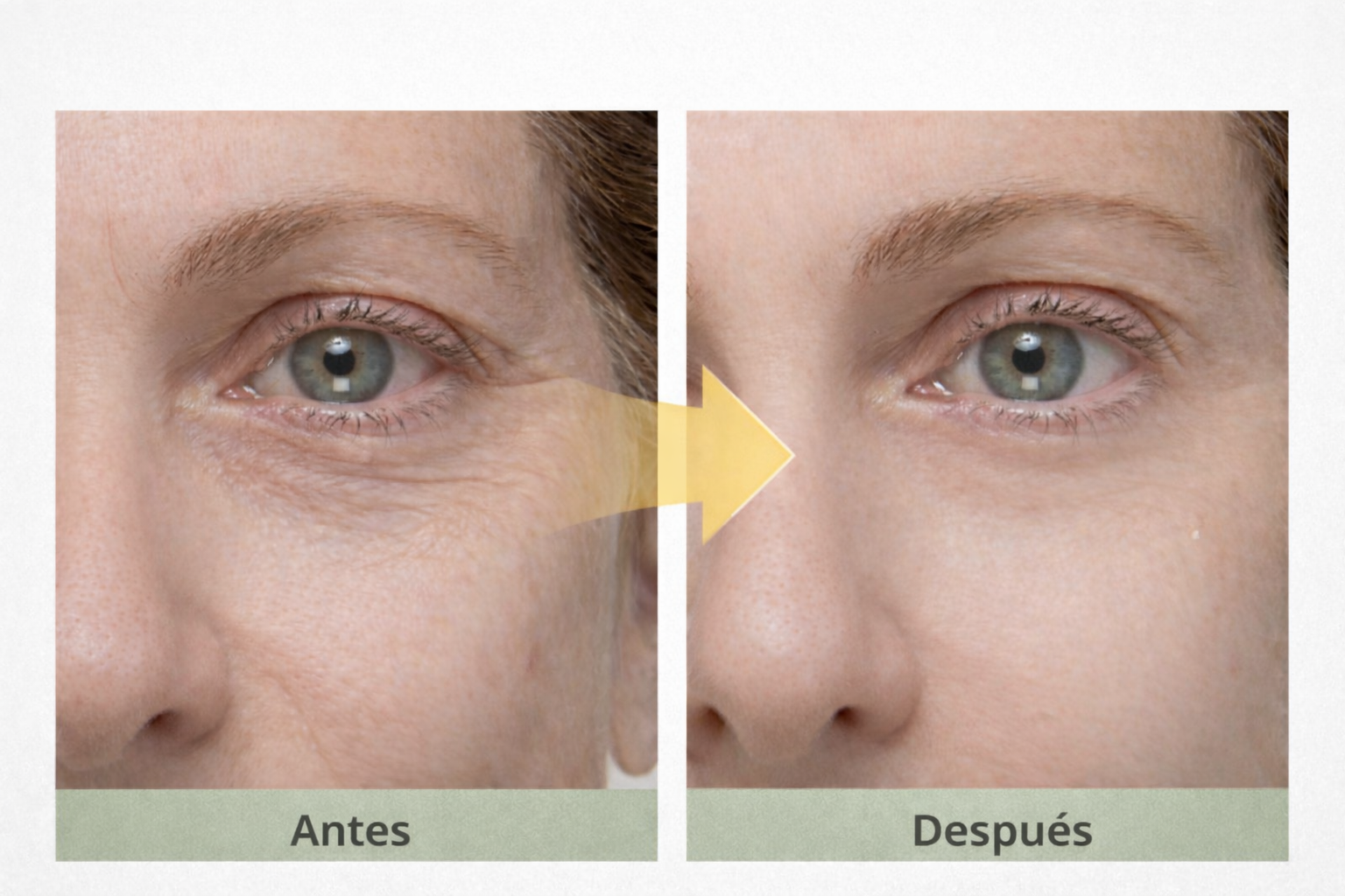 Gel tensor rejuvenecedor de ojos | Resultados visibles desde la primera aplicación.